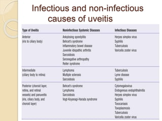 Infectious and non-infectious
causes of uveitis
 