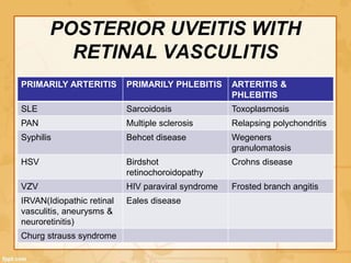 POSTERIOR UVEITIS WITH
RETINAL VASCULITIS
PRIMARILY ARTERITIS PRIMARILY PHLEBITIS ARTERITIS &
PHLEBITIS
SLE Sarcoidosis Toxoplasmosis
PAN Multiple sclerosis Relapsing polychondritis
Syphilis Behcet disease Wegeners
granulomatosis
HSV Birdshot
retinochoroidopathy
Crohns disease
VZV HIV paraviral syndrome Frosted branch angitis
IRVAN(Idiopathic retinal
vasculitis, aneurysms &
neuroretinitis)
Eales disease
Churg strauss syndrome
 