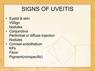 SIGNS OF UVEITIS
• Eyelid & skin
Vitiligo
Nodules
• Conjunctiva
Perilimbal or diffuse injection
Nodules
• Corneal endothelium
KPs
Fibrin
Pigment(nonspecific)
 