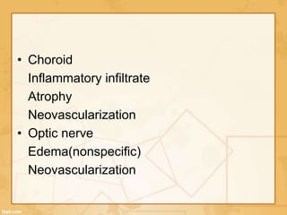 • Choroid
Inflammatory infiltrate
Atrophy
Neovascularization
• Optic nerve
Edema(nonspecific)
Neovascularization
 