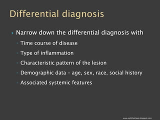 Common Causes of Uveitis Part1
