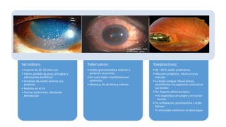Sarcoidosis:
• mujeres de 20 -50 años con
• Fiebre, pérdida de peso, artralgias y
adenopatías periféricas
• Síntomas de uveítis anterior y/o
posterior.
• Nodulos en el iris
• Formas posteriores: afectación
perivascular
Tuberculosis:
• Uveítis granulomatosa anterior o
posterior recurrente
• No suele haber manifestaciones
sistémicas
• Mantoux, Rx de tórax y cultivos.
Toxoplasmosis:
• 30 - 50 % uveítis posteriores.
• Afección congénita; Afecta al área
macular
• La lesión antigua: Placas blanco
amarillentas con pigmento cicatrizal en
sus bordes
• Dx: Aspecto oftalmoscópico
• Ac específicos en sangre y en humor
acuoso.
• Tx: sulfadiacina, pirimetamina y ácido
folínico
• Corticoides sistémicos en dosis bajas
 