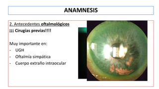 2. Antecedentes oftalmológicos
¡¡¡ Cirugías previas!!!!
Muy importante en:
- UGH
- Oftalmía simpática
- Cuerpo extraño intraocular
ANAMNESIS
 