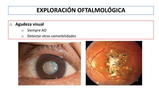 o Agudeza visual
o Siempre AO
o Detectar otras comorbilidades
EXPLORACIÓN OFTALMOLÓGICA
 
