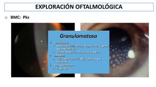 EXPLORACIÓN OFTALMOLÓGICA
o BMC: Pks
 