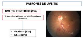 PATRONES DE UVEITIS
UVEITIS POSTERIOR (13%)
3. Vasculitis retiniana sin manifestaciones
sistémicas
 Idiopáticas (57%)
 Behcet (21%)
 