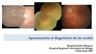 Margarita Jódar Márquez
Hospital Regional Universitario de Málaga
5 Diciembre 2019
Aproximación al diagnóstico de las uveítis
 