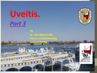 Uveitis.
Part 3
By
Dr. Amr Mounir.MD
Lecturer of Ophthalmology
Sohag University
 