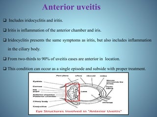Anterior uveitis
 Includes iridocyclitis and iritis.
 Iritis is inflammation of the anterior chamber and iris.
 Iridocyclitis presents the same symptoms as iritis, but also includes inflammation
in the ciliary body.
 From two-thirds to 90% of uveitis cases are anterior in location.
 This condition can occur as a single episode and subside with proper treatment.
 
