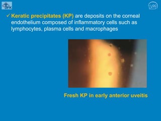 Uveitis signs and symptoms.pptx