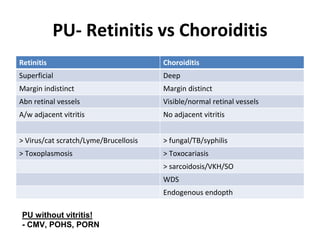 Uveitis: Notes