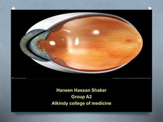 Haneen Hassan Shaker
Group A2
Alkindy college of medicine
 