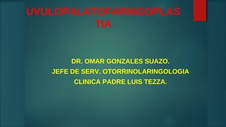 DR. OMAR GONZALES SUAZO.
JEFE DE SERV. OTORRINOLARINGOLOGIA
CLINICA PADRE LUIS TEZZA.
UVULOPALATOFARINGOPLAS
TIA
 