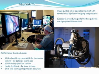 neuroArm
Image guided robot operates inside of 1.5T
MRI for Intra-operative imaging and guidance
Successful procedures performed on patients
at Calgary Foothills Hospital
Performance Goals achieved:
• 15 Hz closed loop bandwidth for immersive
control – no delay or overshoot
• 50 micron tip position control
• Haptic feedback – 2g force sensing
• 1mm tool to image registration accuracy
 