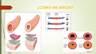 ¿COMO ME AFECTA? 
 