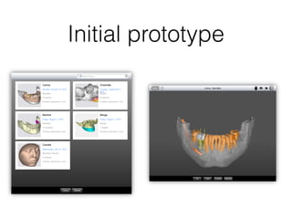 Initial prototype
 