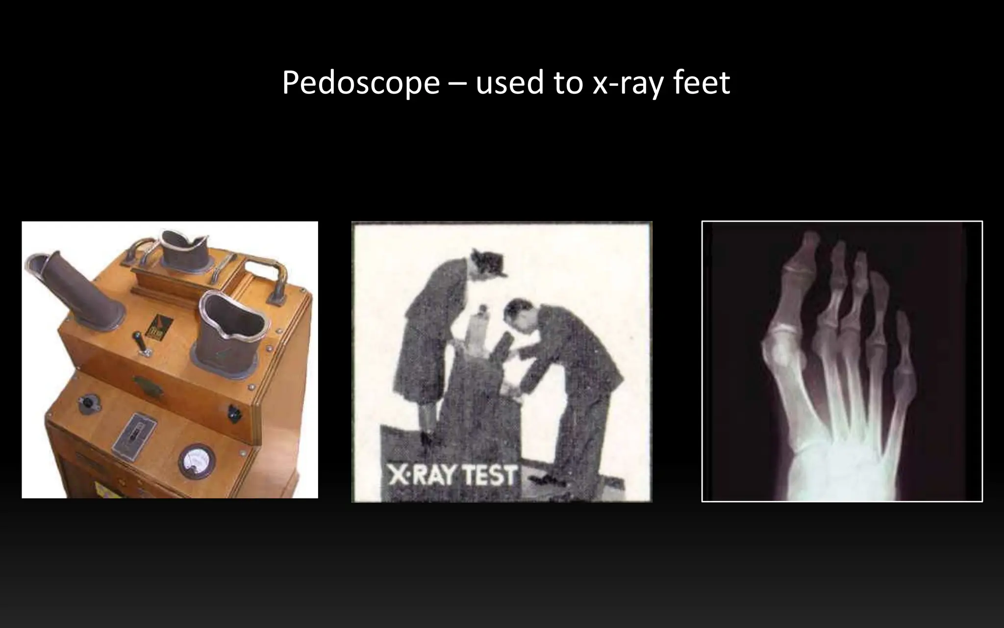 Pedoscope – used to x-ray feet