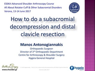 www.shoulder.gr
E. Antonogiannakis How to do a subacromial decompression and distal clavicle resection
Verona 13.06.2017
How to do a subacromial
decompression and distal
clavicle resection
Manos Antonogiannakis
Orthopaedic Surgeon
Director of 3rd Orthopaedic Department
Centre for Arthroscopy & Shoulder Surgery
Hygeia General Hospital
ESSKA Advanced Shoulder Arthroscopy Course
All About Rotator Cuff & Other Subacromial Disorders
Verona, 13-14 June 2017 .
 