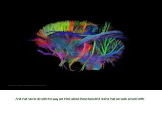 Human brain connections image: Barcroft Media via Daily Mail
And that has to do with the way we thin about these beautiful...