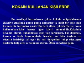 KOKAİN KULLANAN KİŞİLERDEKOKAİN KULLANAN KİŞİLERDE;;
Bu maddeyi burunlarına çeken kokain müptelalarınınBu maddeyi burunlarına çeken kokain müptelalarının
ekseriye etrafında parça parça damarlar ve hafif bir leke olanekseriye etrafında parça parça damarlar ve hafif bir leke olan
kırmızı bir burunları vardır.Bu deri altına çekenlerde ise eroinkırmızı bir burunları vardır.Bu deri altına çekenlerde ise eroin
kullananlarınkine benzer iğne izleri bulunabilir.Kokaininkullananlarınkine benzer iğne izleri bulunabilir.Kokainin
devamlı olarak kullanılması aşırı yüz sararması, baş dönmesi,devamlı olarak kullanılması aşırı yüz sararması, baş dönmesi,
kusma ve fazla heyecanlılıkla beraber ani kilo kaybına vekusma ve fazla heyecanlılıkla beraber ani kilo kaybına ve
vücutta halsizliğe yol açar Bu hali durgunluk takip eder.Aşırıvücutta halsizliğe yol açar Bu hali durgunluk takip eder.Aşırı
dozlarda kalp atışı ve solunum durur. Ölüm meydana gelir.dozlarda kalp atışı ve solunum durur. Ölüm meydana gelir.
 