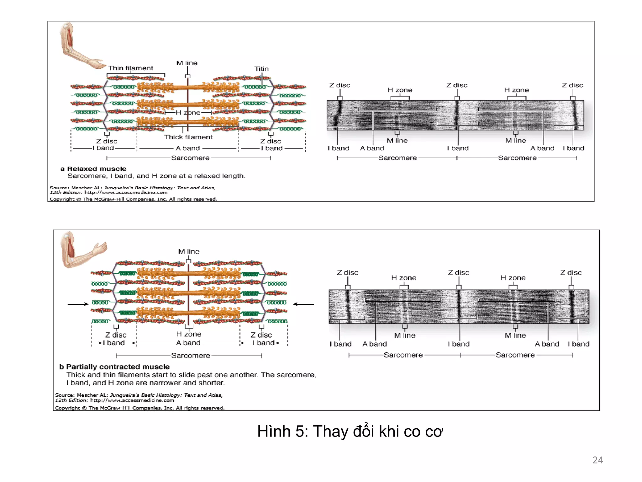 Hình 5: Thay đổi khi co cơ
24
 