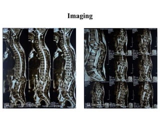 Imaging
 