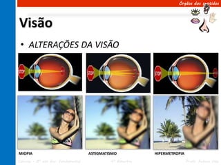 Órgãos dos sentidos




Visão
 • ALTERAÇÕES DA VISÃO




MIOPIA                               ASTIGMATISMO           HIPERMETROPIA
Ciências – 8º ano Ens. Fundamental            4º Bimestre                   Profa. Rebeca Vale
 