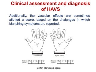 Clinical assessment and diagnosis
of HAVS
Additionally, the vascular effects are sometimes
allotted a score, based on the phalanges in which
blanching symptoms are reported.
Griffin blanching score
 