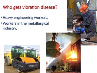 Who gets vibration disease?
•Heavy engineering workers,
•Workers in the metallurgical
industry,
 