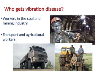 Who gets vibration disease?
•Workers in the coal and
mining industry,
•Transport and agricultural
workers.
 