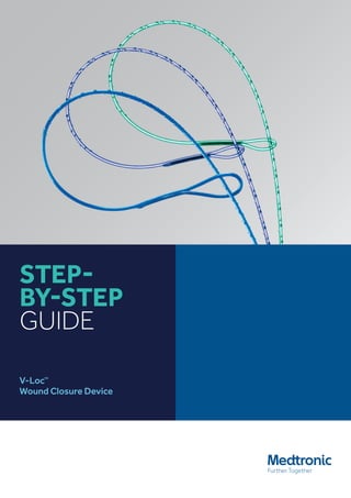STEP-
BY-STEP
GUIDE
V-Loc™
Wound Closure Device
 