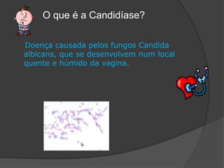            O que é a Candidíase?    Doença causada pelos fungos Candidaalbicans, que se desenvolvem num local quente e húmido da vagina.
