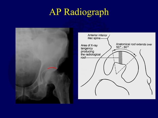 V04 anatomy class_acetab | PPT