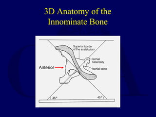 V04 anatomy class_acetab | PPT