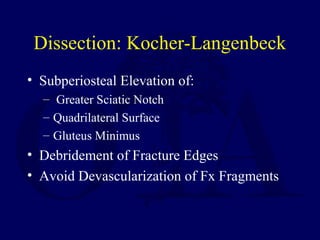 Dissection: Kocher-Langenbeck
• Subperiosteal Elevation of:
– Greater Sciatic Notch
– Quadrilateral Surface
– Gluteus Minimus
• Debridement of Fracture Edges
• Avoid Devascularization of Fx Fragments
 