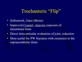 Trochanteric “Flip”
• Seibenrock, Ganz (Berne)
• Improved Cranial, Anterior exposure of
innominate bone
• Direct intra-articular evaluation of joint, reduction
• Most useful for PW fractures with extension to the
supraacetabular ilium
 
