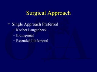 Surgical Approach
• Single Approach Preferred
– Kocher Langenbeck
– Ilioinguinal
– Extended Iliofemoral
 