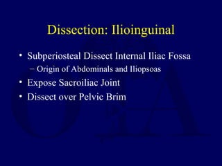 Dissection: Ilioinguinal
• Subperiosteal Dissect Internal Iliac Fossa
– Origin of Abdominals and Iliopsoas
• Expose Sacroiliac Joint
• Dissect over Pelvic Brim
 
