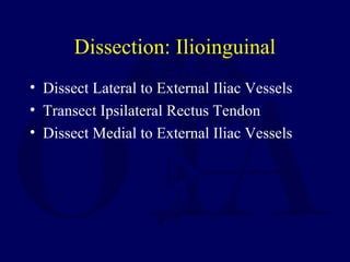 Dissection: Ilioinguinal
• Dissect Lateral to External Iliac Vessels
• Transect Ipsilateral Rectus Tendon
• Dissect Medial to External Iliac Vessels
 