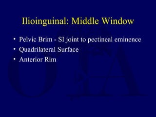 Ilioinguinal: Middle Window
• Pelvic Brim - SI joint to pectineal eminence
• Quadrilateral Surface
• Anterior Rim
 