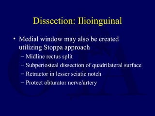 Dissection: Ilioinguinal
• Medial window may also be created
utilizing Stoppa approach
– Midline rectus split
– Subperiosteal dissection of quadrilateral surface
– Retractor in lesser sciatic notch
– Protect obturator nerve/artery
 