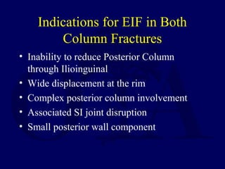 Indications for EIF in Both
Column Fractures
• Inability to reduce Posterior Column
through Ilioinguinal
• Wide displacement at the rim
• Complex posterior column involvement
• Associated SI joint disruption
• Small posterior wall component
 