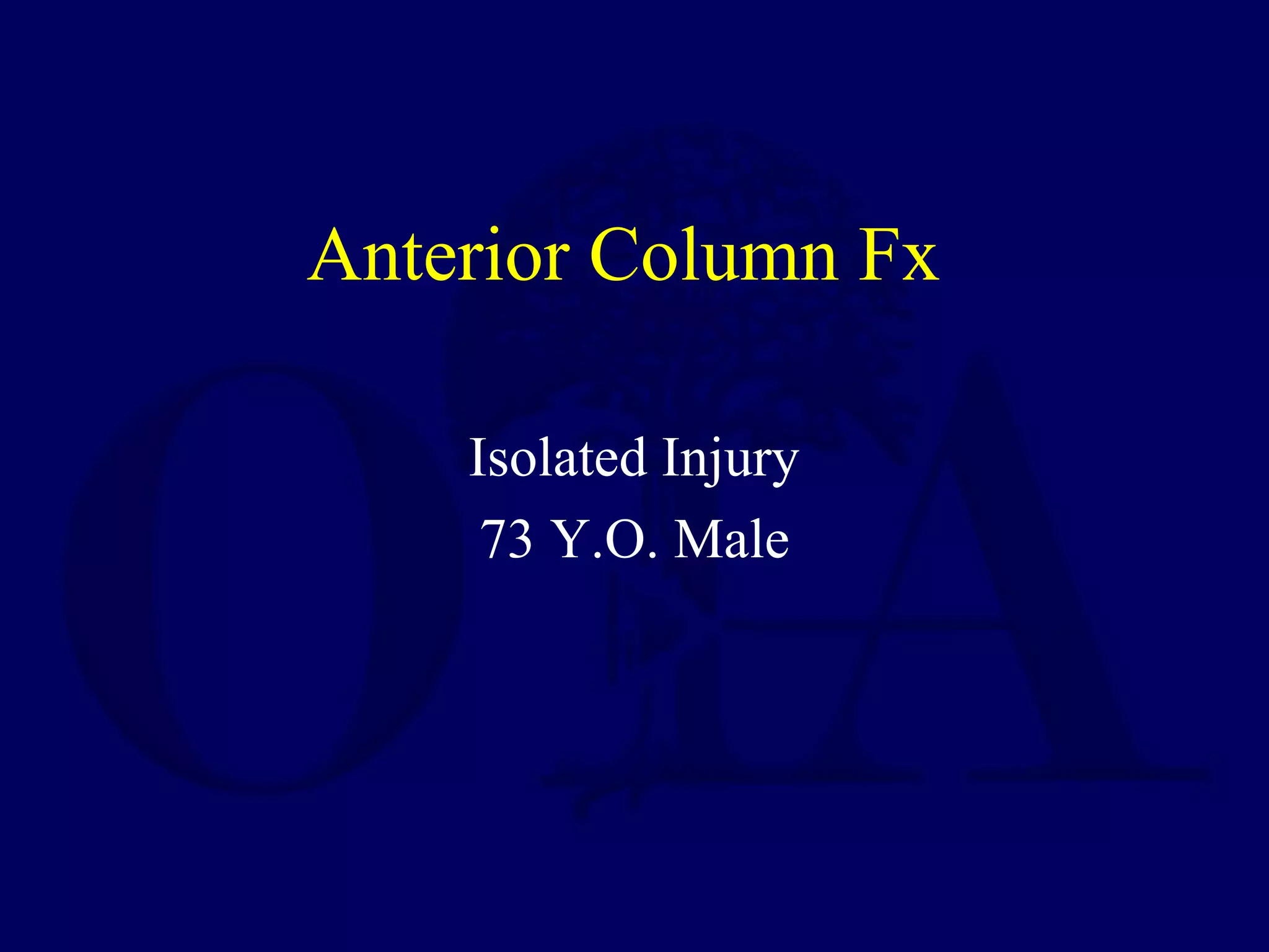 Anterior Column Fx
Isolated Injury
73 Y.O. Male
 