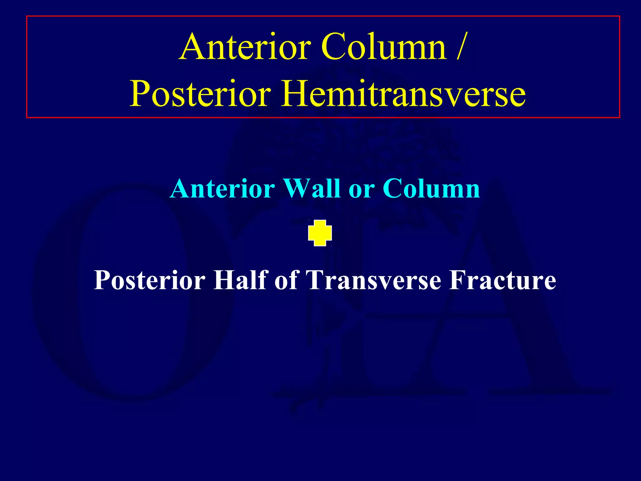 Anterior Column /
Posterior Hemitransverse
Anterior Wall or Column
Posterior Half of Transverse Fracture
 
