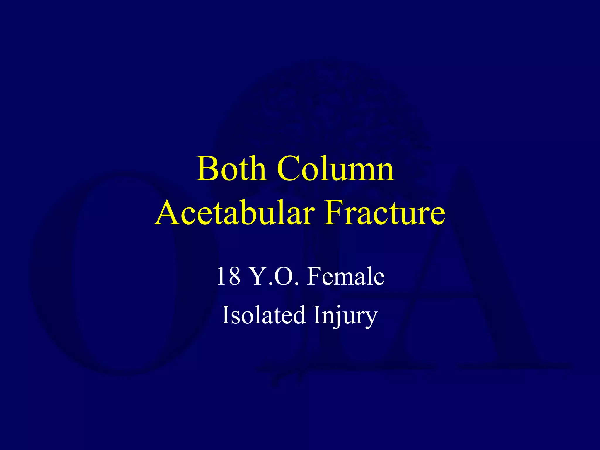 Both Column
Acetabular Fracture
18 Y.O. Female
Isolated Injury
 