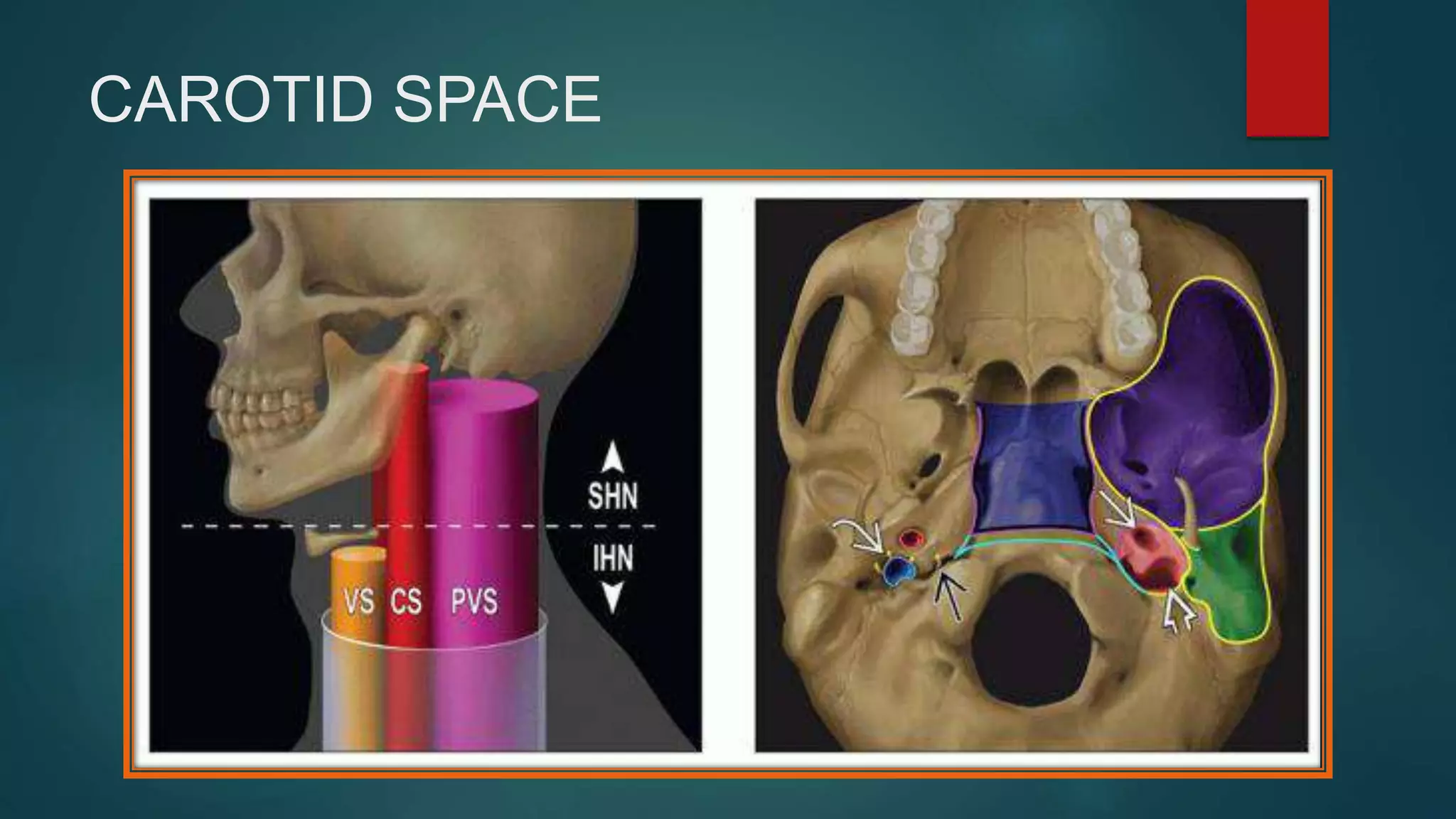 CAROTID SPACE
 