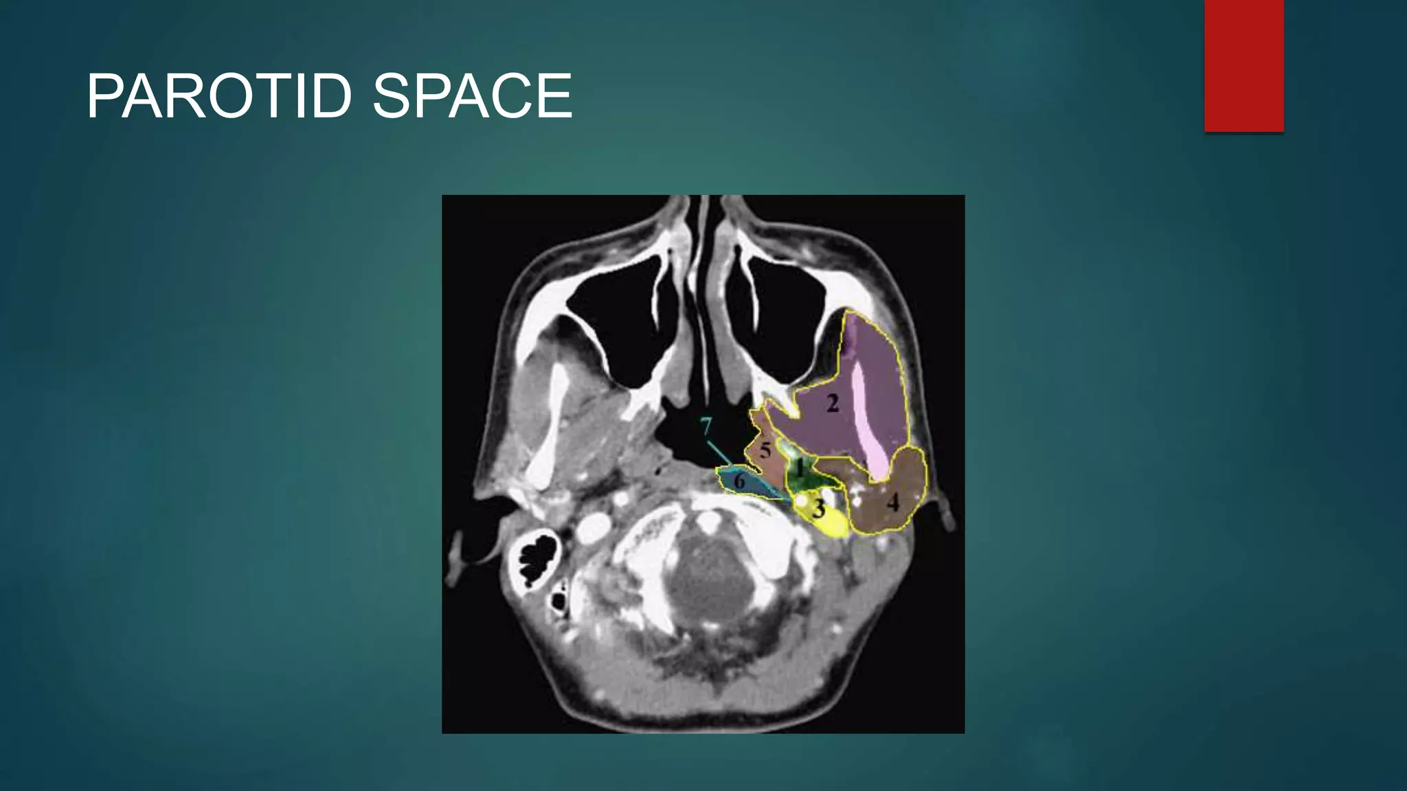 PAROTID SPACE
 