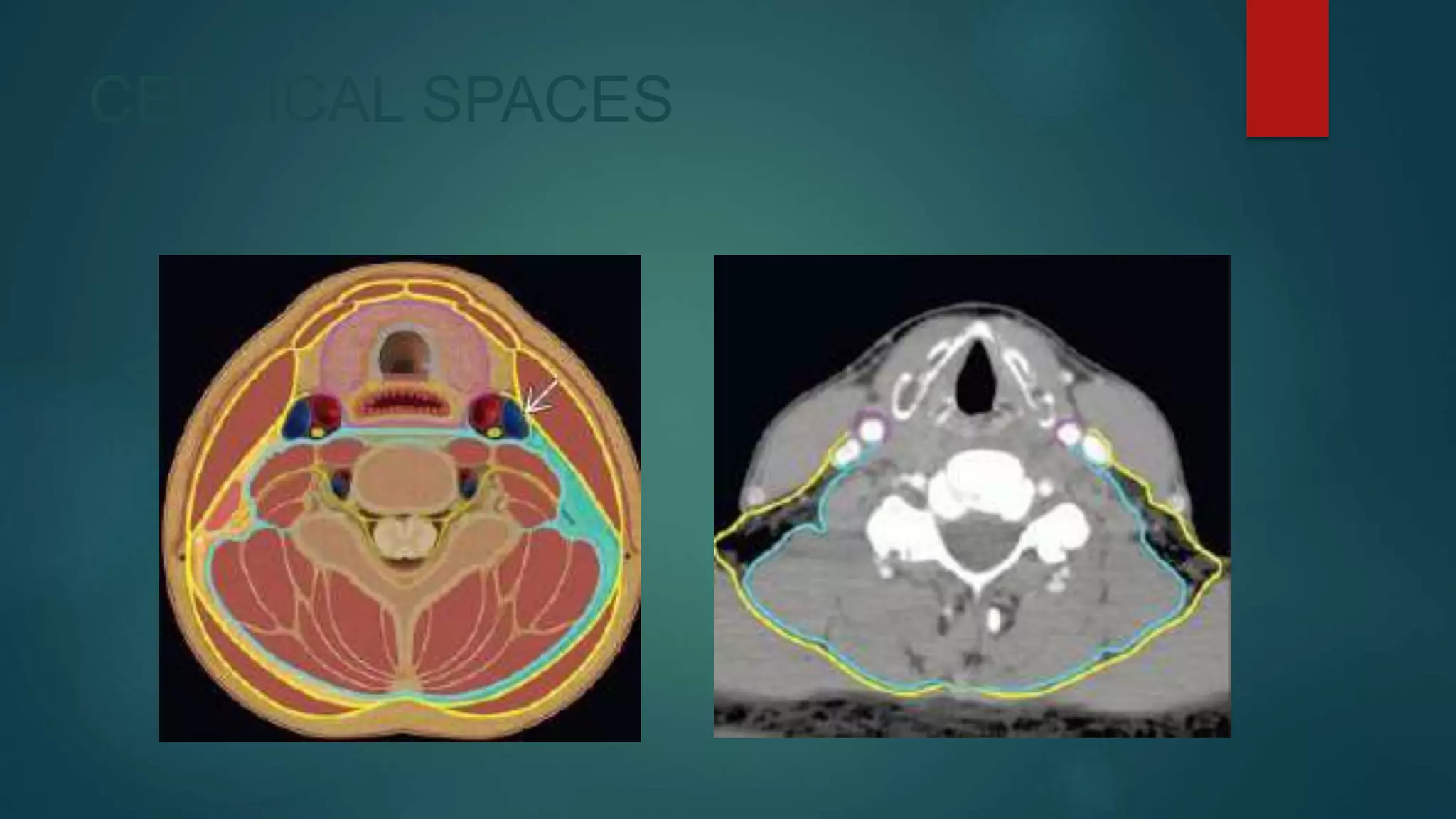 CERVICAL SPACES
 