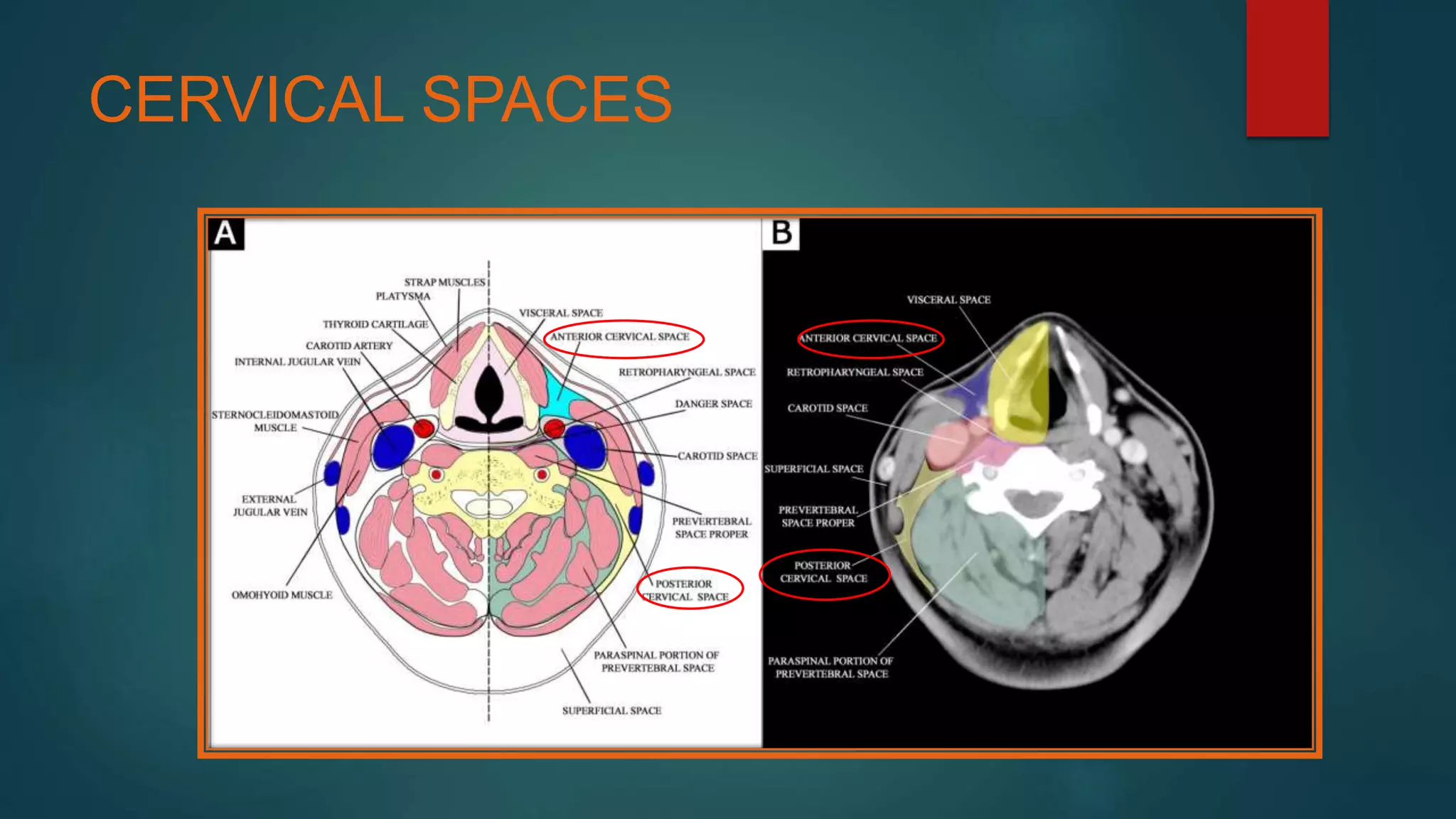 CERVICAL SPACES
 