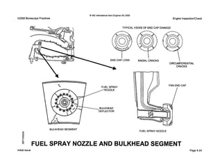 V2500 Borescope Practices
0 IAE InternationalAero Engines AG 2000
Engine Inspection/Check
TYPICALVIEWS OF END CAP DAMAGE
LOSS RADIAL CRACKS 
CIRCUMFERENTIAL
CRACKS
CAP
FUEL SPRAY
BULKHEAD SEGMENT
FUEL SPRAY NOZZLE
FUEL SPRAY NOZZLE AND BULKHEAD SEGMENT
Page 4-24Initial issue
 